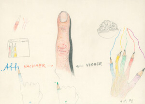 Aff … NACHHER – VORHER (aka Finger)