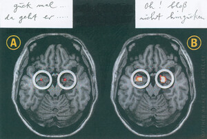 Amygdala (guck mal da geht er… Oh! bloß nicht hingucken)